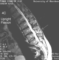 Ligament_4c MRI