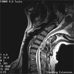 Upright MRI scanning the neck